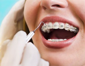 Can I use my HSA or FSA to pay for dental services?