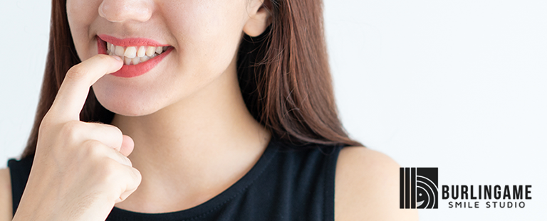 Burlingame Smile studio banner of a woman smiling and pointing to her teeth