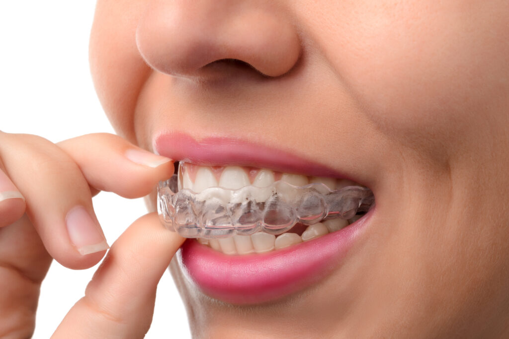 Orthodontist for teens and adults in Burlingame, CA