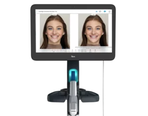 iTero Smile Simulator - Burlingame Orthodontist