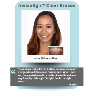 Real Patient Testimonial of treatment from Burlingame Dentist Dr. Lee