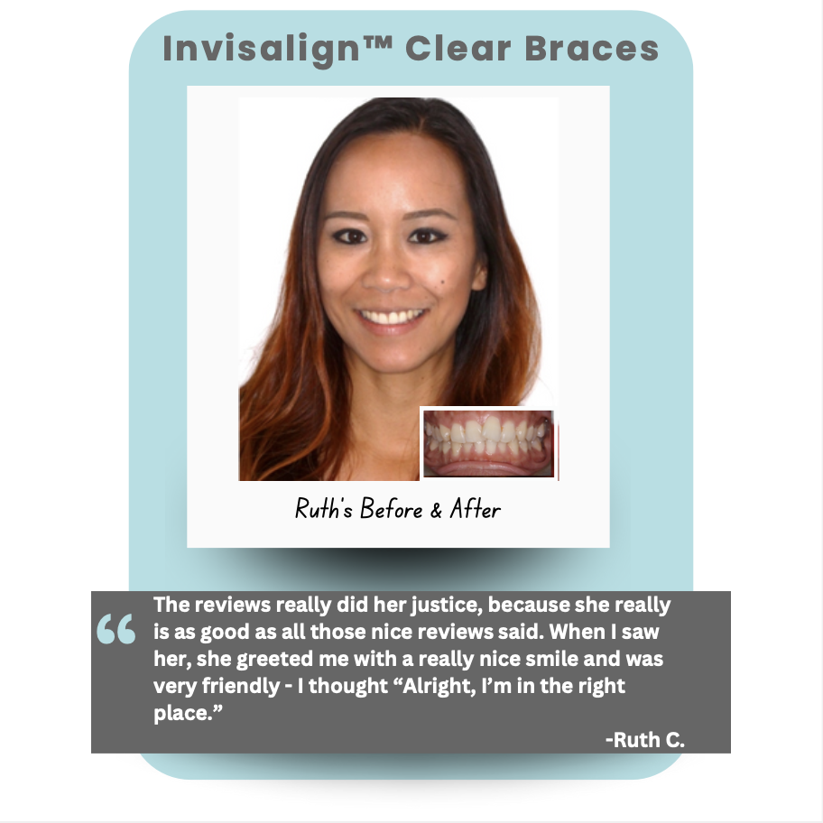 Orthodontic patient testimonial for Burlingame Smile Studio