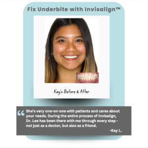 Real Patient Testimonial of treatment from Burlingame Dentist Dr. Lee