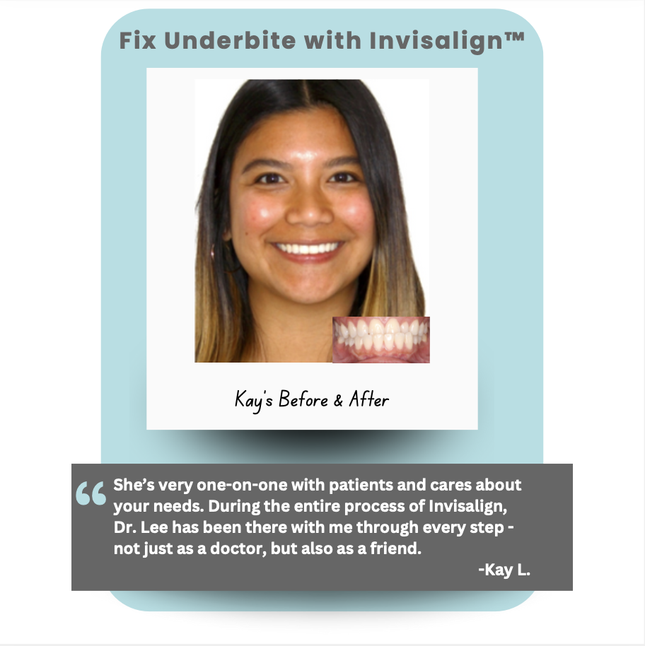 Real Patient Testimonial of treatment from Burlingame Dentist Dr. Lee