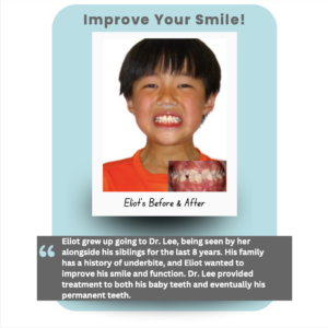 Real Patient Testimonial of treatment from Burlingame Dentist Dr. Lee