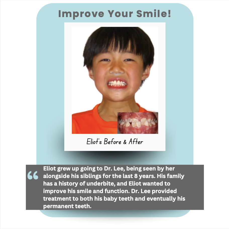 Orthodontic patient testimonial for Burlingame Smile Studio