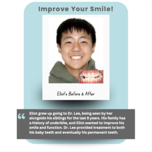 Real Patient Testimonial of treatment from Burlingame Dentist Dr. Lee