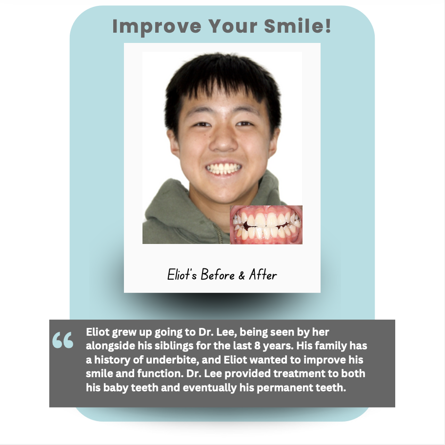Real Patient Testimonial of treatment from Burlingame Dentist Dr. Lee